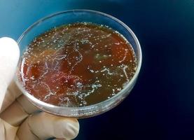 wetenschapper of arts die petrischaal met bacteriekolonie vasthoudt. enterobacter spp. urinecultuur. dichtbij bekijken. foto