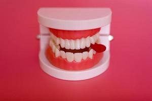 grappig orthodontisch tandmodel en rood hart op roze achtergrond. demonstratiemodel van tanden van verschillende soorten orthodontische beugels of beugels. foto