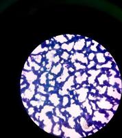 microscopisch beeld van hematologie-dia. dichtbij bekijken. foto