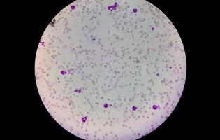 microscopisch beeld van hematologie-dia. dichtbij bekijken. foto