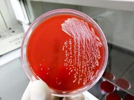 staphylococcus aureus, grampositief, tot gram variabel, niet-beweeglijk, coccus, bèta-hemolyse, saprotrofe bacterie die behoort tot de familie staphylococcus groei op bloedagar. foto