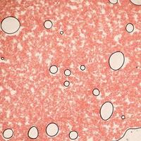 bloeduitstrijkje onder microscoop aanwezige neutrofielen en rode bloedcellen. fotomicrosecties met hoge vergroting met lichtmicroscoop foto