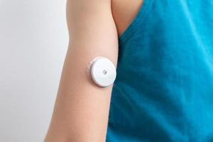 bloedglucosesensor op de arm van een kind. sensor voor het op afstand meten van bloedglucosewaarden met behulp van nfc-technologie op een mobiele telefoon of reader foto