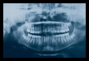 medische röntgenbeeldvorming van menselijke tanden van een kind foto