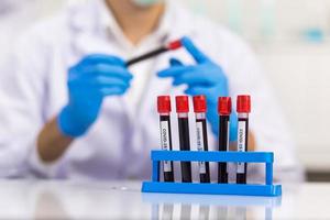 rek met bloedbuizen met een label voor virusidentificatie wordt voor een microbioloog geplaatst die in het laboratorium werkt. foto