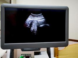 medische ultrasone machine in de diagnostische kamer van het ziekenhuis foto