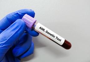 acute myeloïde leukemie of aml genetische testen foto