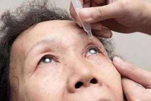 close-up van oudere vrouw druppelt oogdruppels in haar ogen. behandeling van oogziekten. gezondheidszorg concept foto