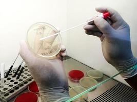 technicus die werkt met bacteriestammen in het microbiologisch laboratorium. foto