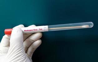 vesicles vloeistofmonster voor monkeypox-virustest. foto