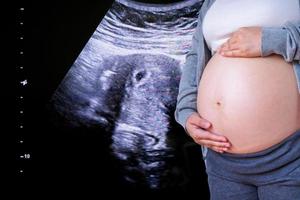 zwangere vrouw met echografie apparatuur achtergrond foto