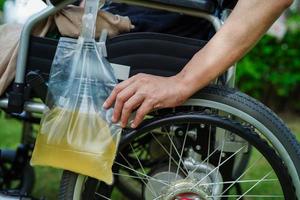 Aziatische handicap vrouw met urinezak op rolstoel. foto