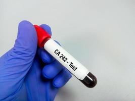 bloedmonster voor ca. 242 test voor de diagnose van alvleesklierkanker. foto
