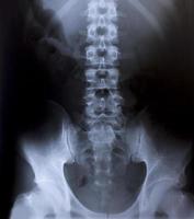 röntgenfoto van de menselijke borst voor een medische diagnose foto
