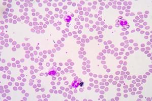 witte bloedcellen van een mens, foto