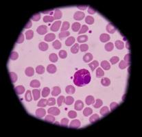 eosinofiele granulocyten foto