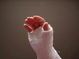 gewonde hand met cast