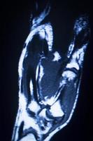 mri magnetische resonantie beeldvorming medische scan