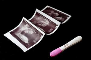 zwangerschapstest en echo's foto