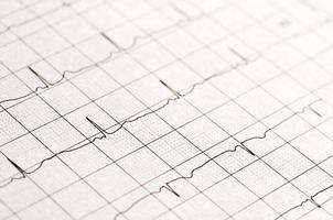 close up op een normaal elektrocardiogram foto