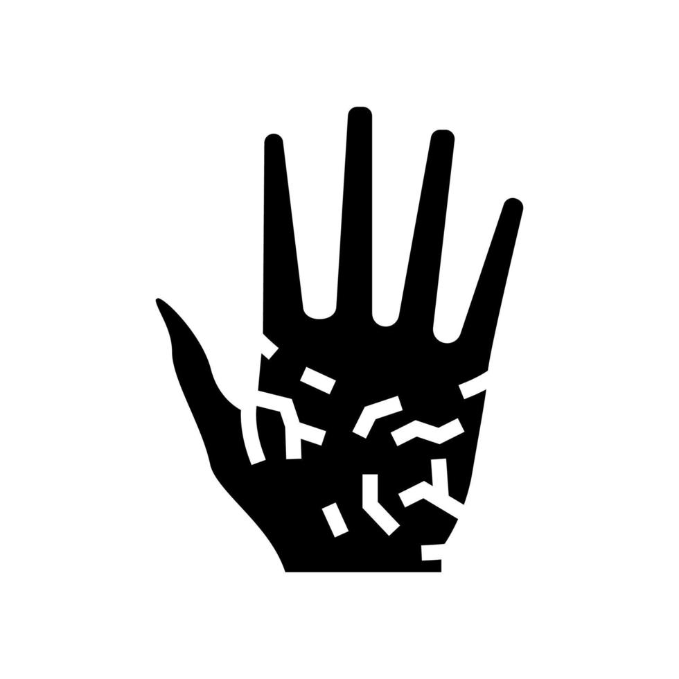 handpalmen droge huid glyph pictogram vectorillustratie vector