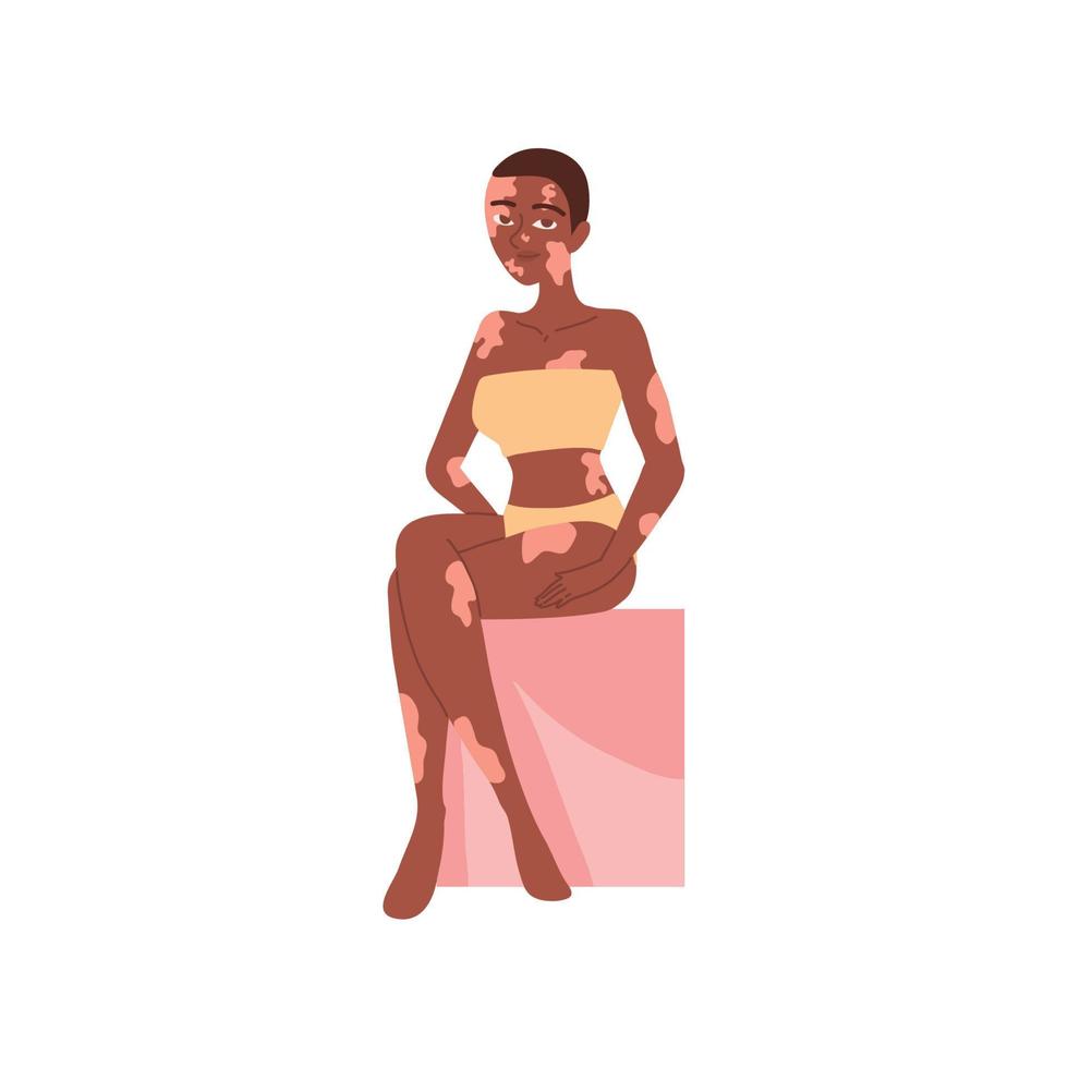 afro vrouw met vitiligo vector