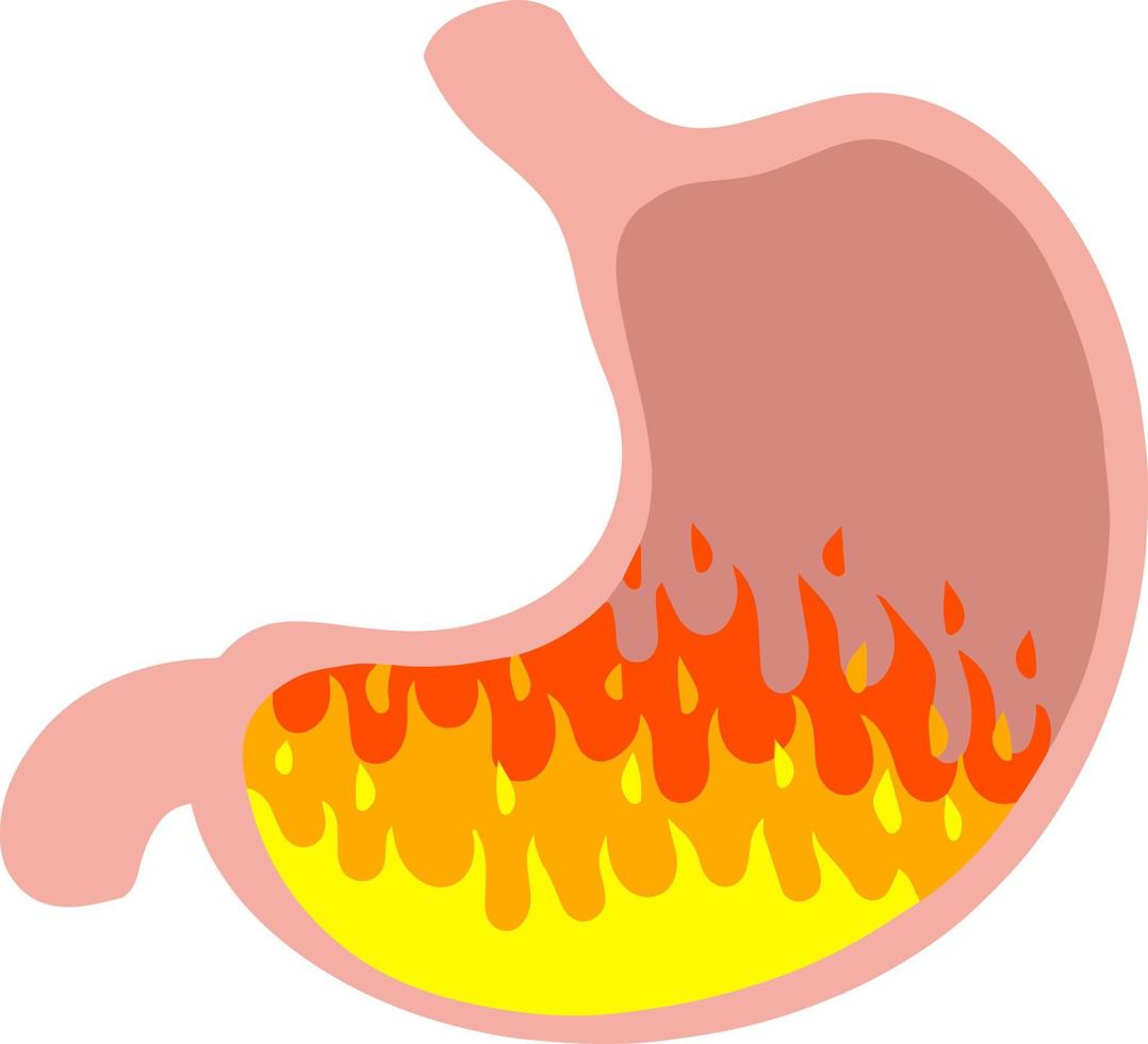 spijsvertering problemen. maagzuur in maag. medisch zorg. indigestie in buik. brand en intern orgaan van Mens. symbool van pittig voedsel en peper. tekenfilm vlak illustratie vector