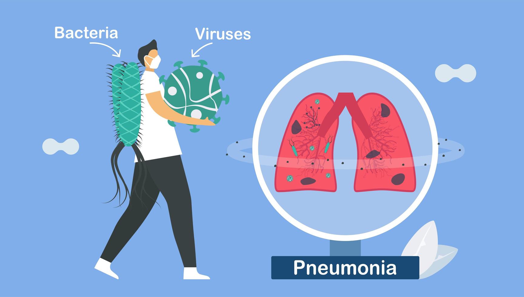 longontsteking is een infectie die de luchtzakjes doet ontvlammen vector