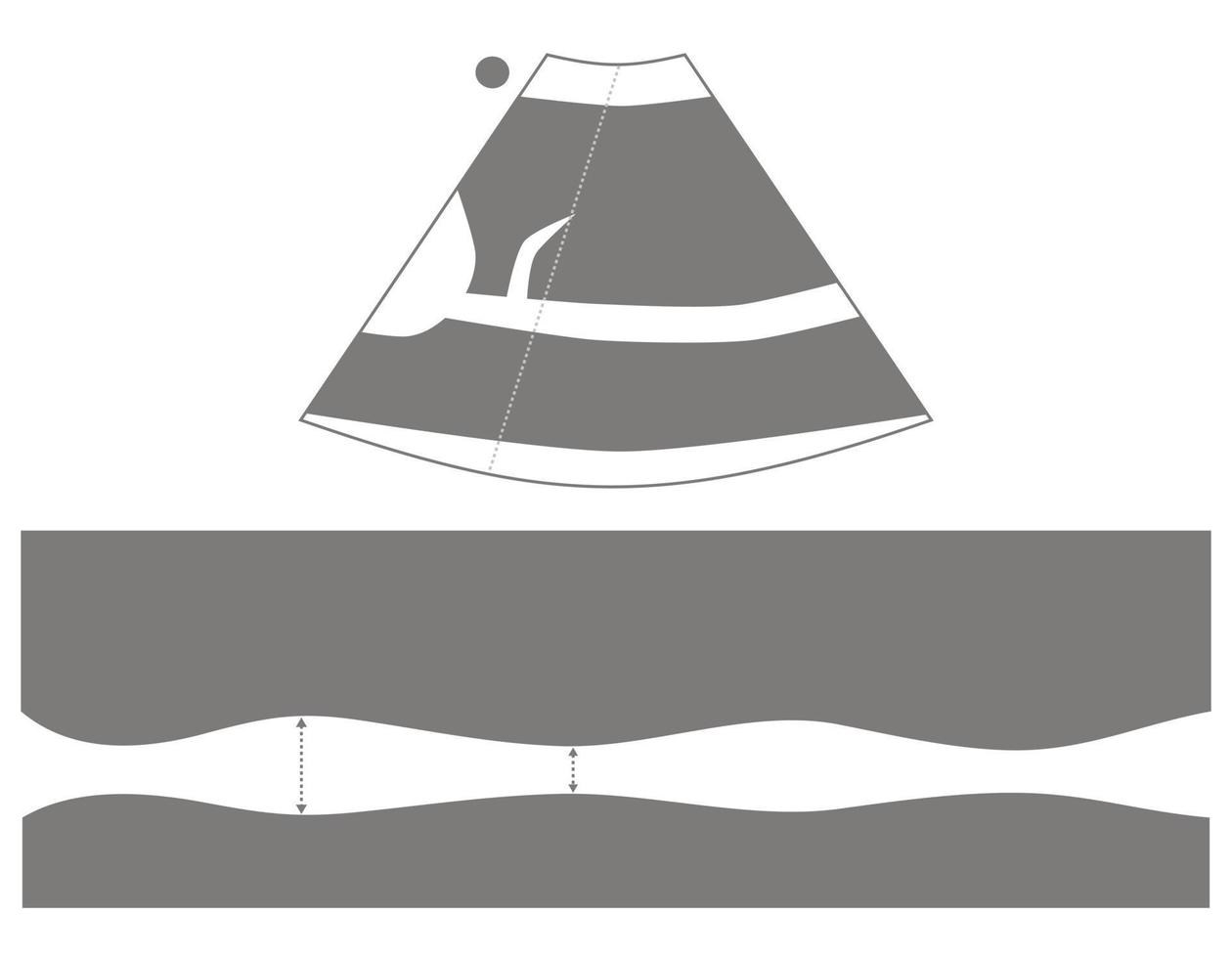 diagram van inferieur vena cava echografie in m mode vector