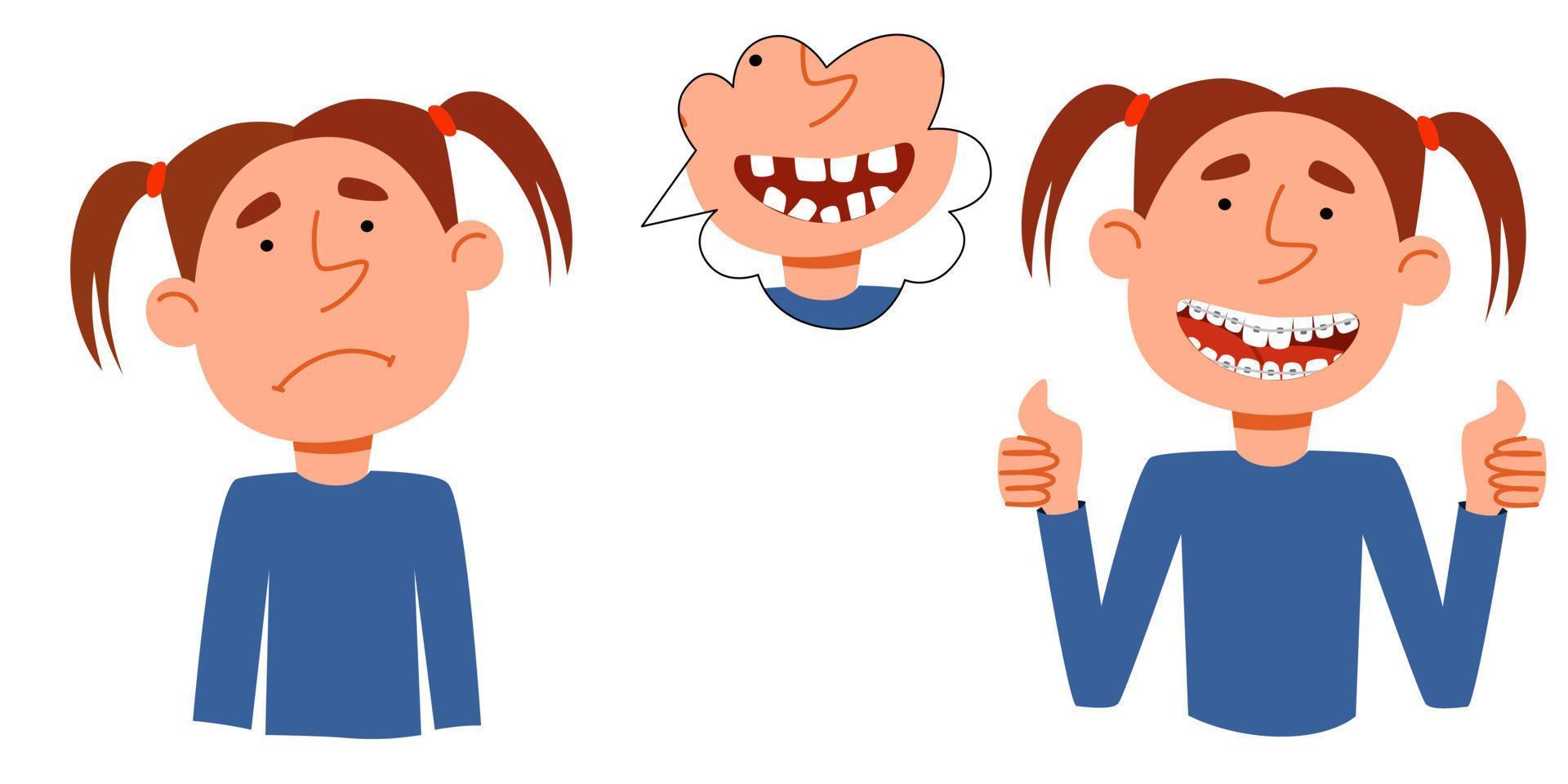 concept van een illustratie Aan de onderwerp van corrigeren een glimlach. de meisje s karakter krijgt van streek omdat van haar scheef tanden, een tiener met een beugel shows klas. vector