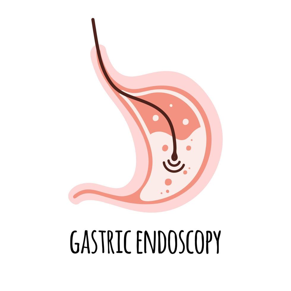 endoscopie. de maag van een gezond persoon. gastro-enterologie. vector illustratie in een vlak stijl.