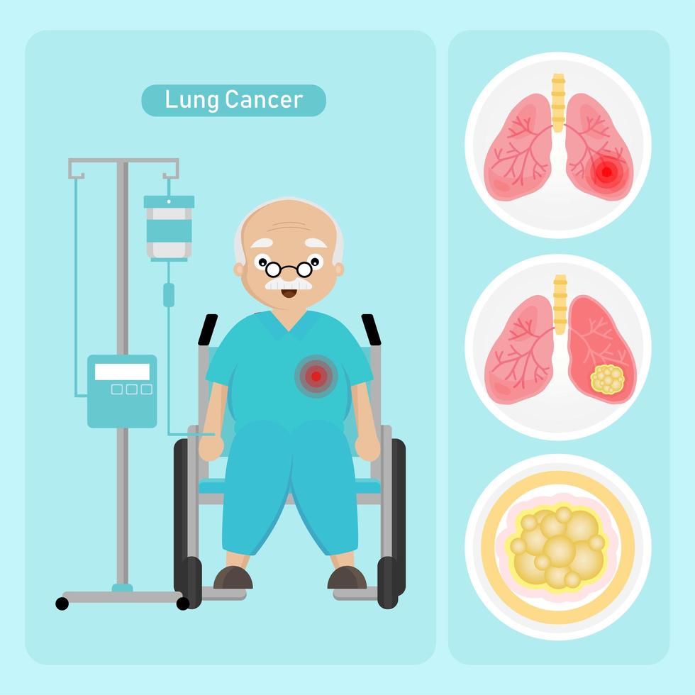 senior man met longkanker vector