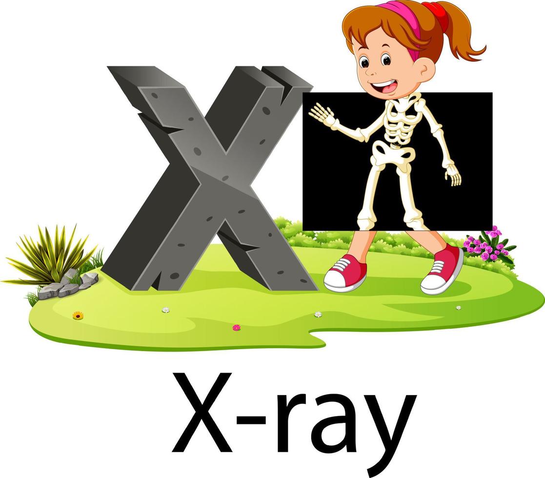 alfabet X voor röntgenstraal met de mooi zo animatie naast vector