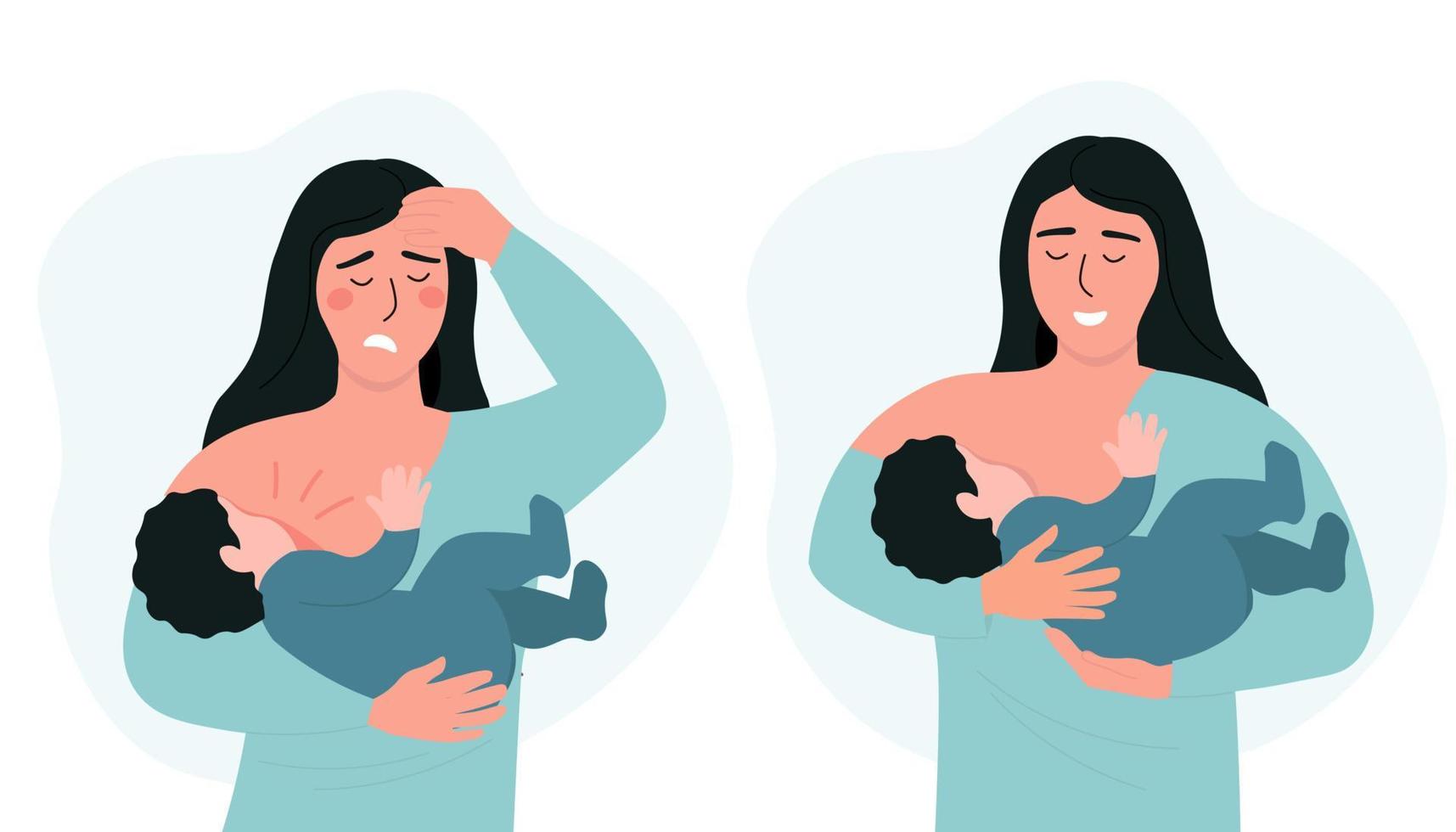 een vrouw is borstvoeding geeft een baby. de ontwikkeling van ontsteking, pijn in mastitis. gepast voeden van de kind door de moeder. vector grafiek.
