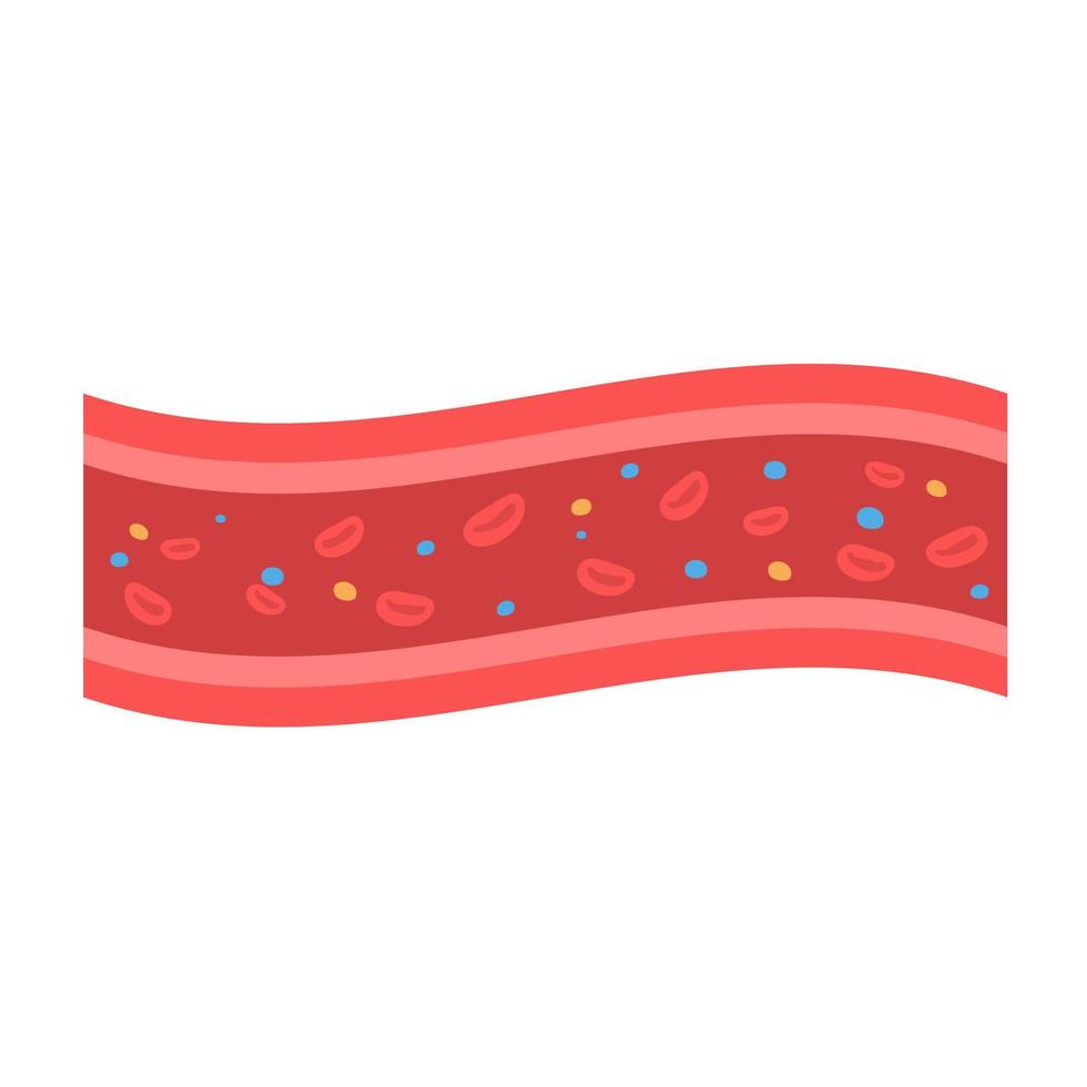coronaire slagaders met geaccumuleerd dik in de lichaam vector