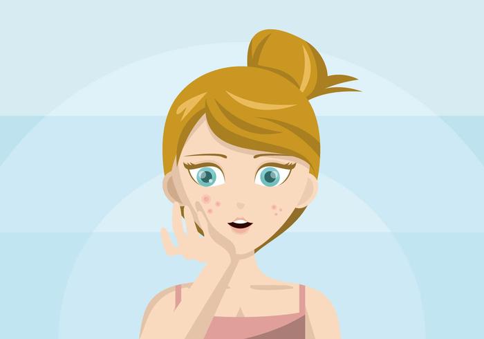 Pimple Illustratie vector