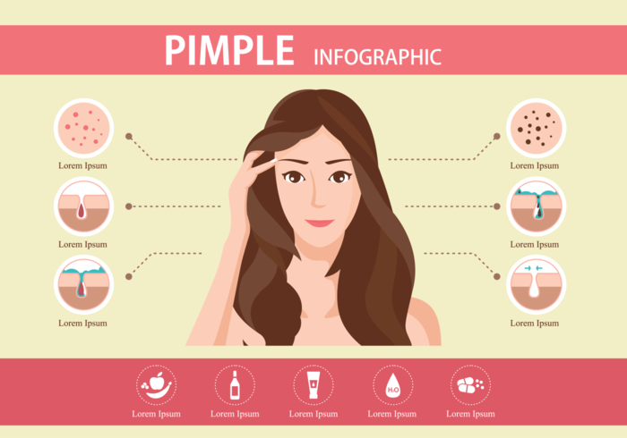 pimple infographic vector