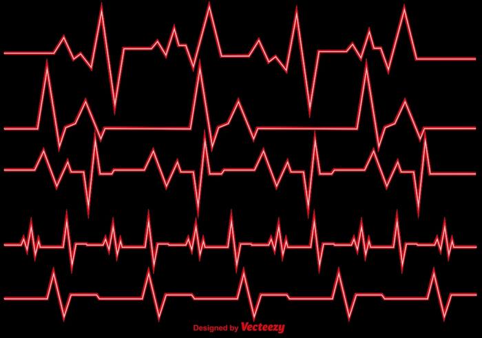 Vectorillustratie Hartritme EKG Vector