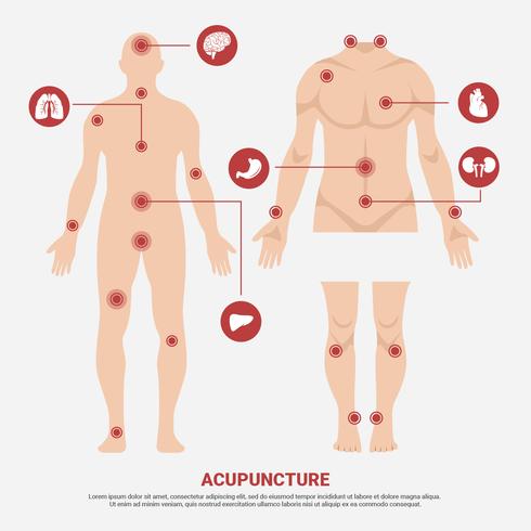 Acupunctuurpunt in de vectorillustratie van het mensenlichaam vector