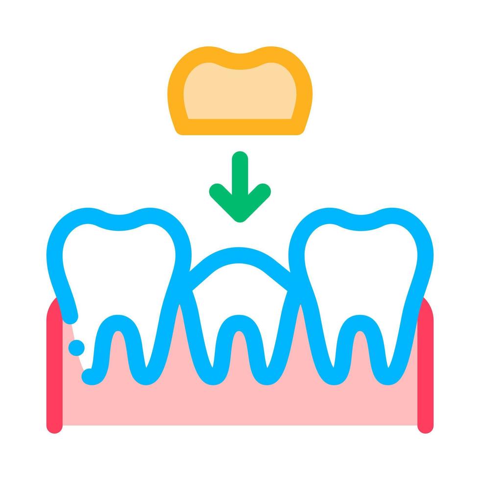stomatologie tand kroon vector dun lijn teken icoon