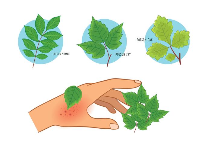 gifsumak eiken sumak uitslag vector