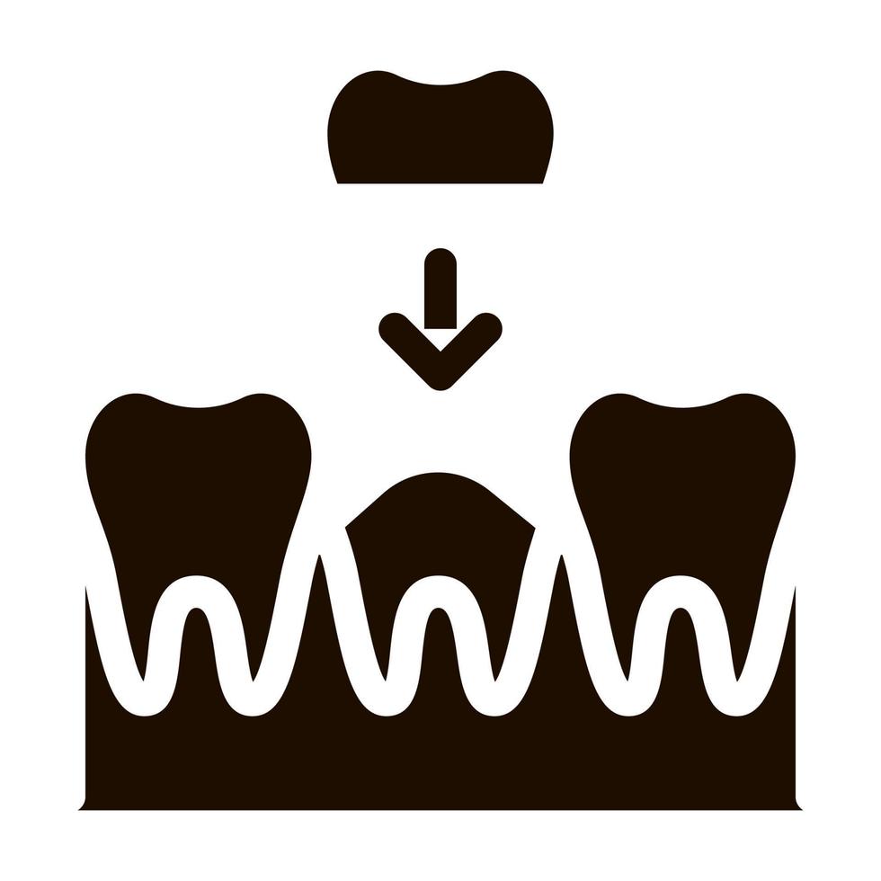 stomatologie tand kroon vector teken icoon