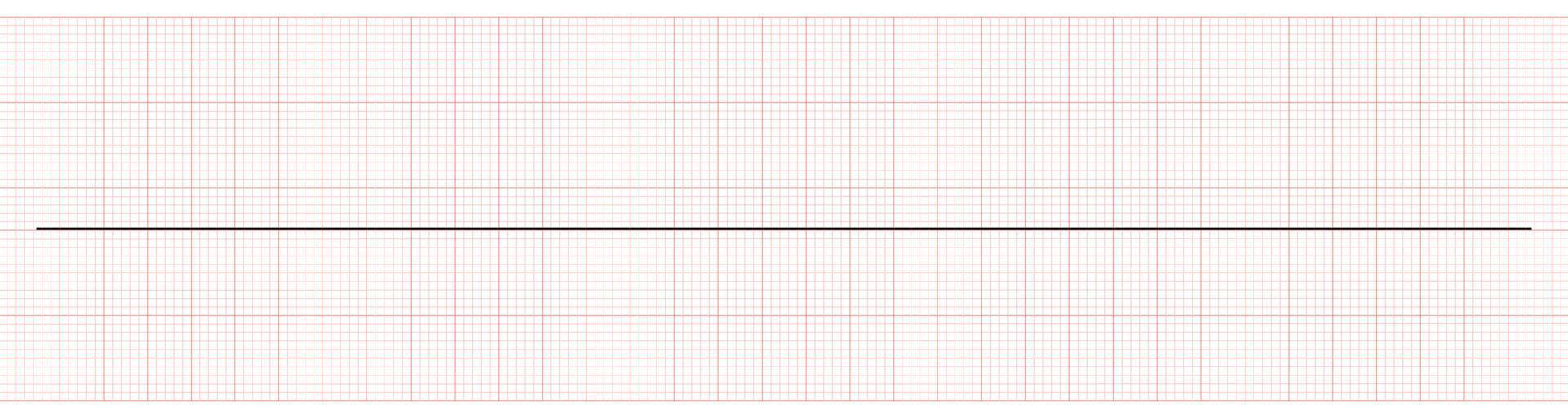 ekg tonen vlak lijn of asystolie vector