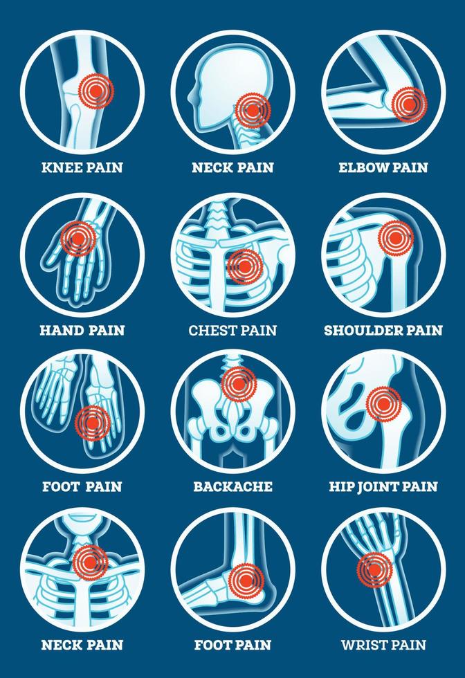 lichaamspijn ingesteld. pijn in rugpijn, heupgewricht, knie, elleboog, hand, voet, schouder, nek, borst en pols. vector