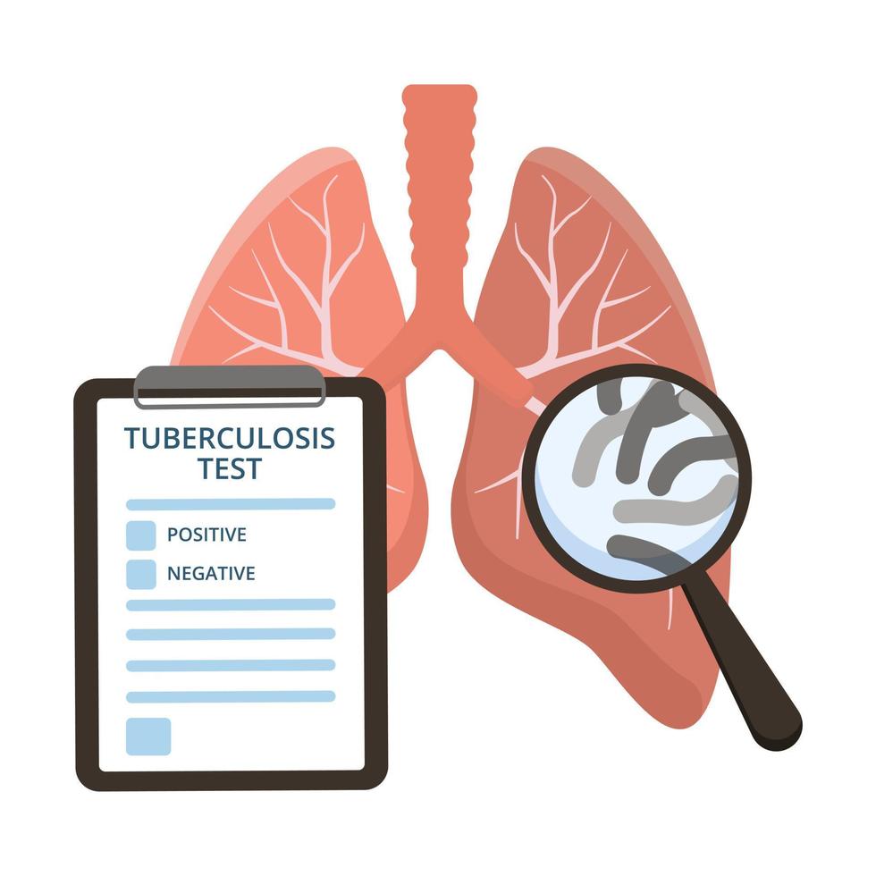 menselijk longen tuberculose test concept. vector