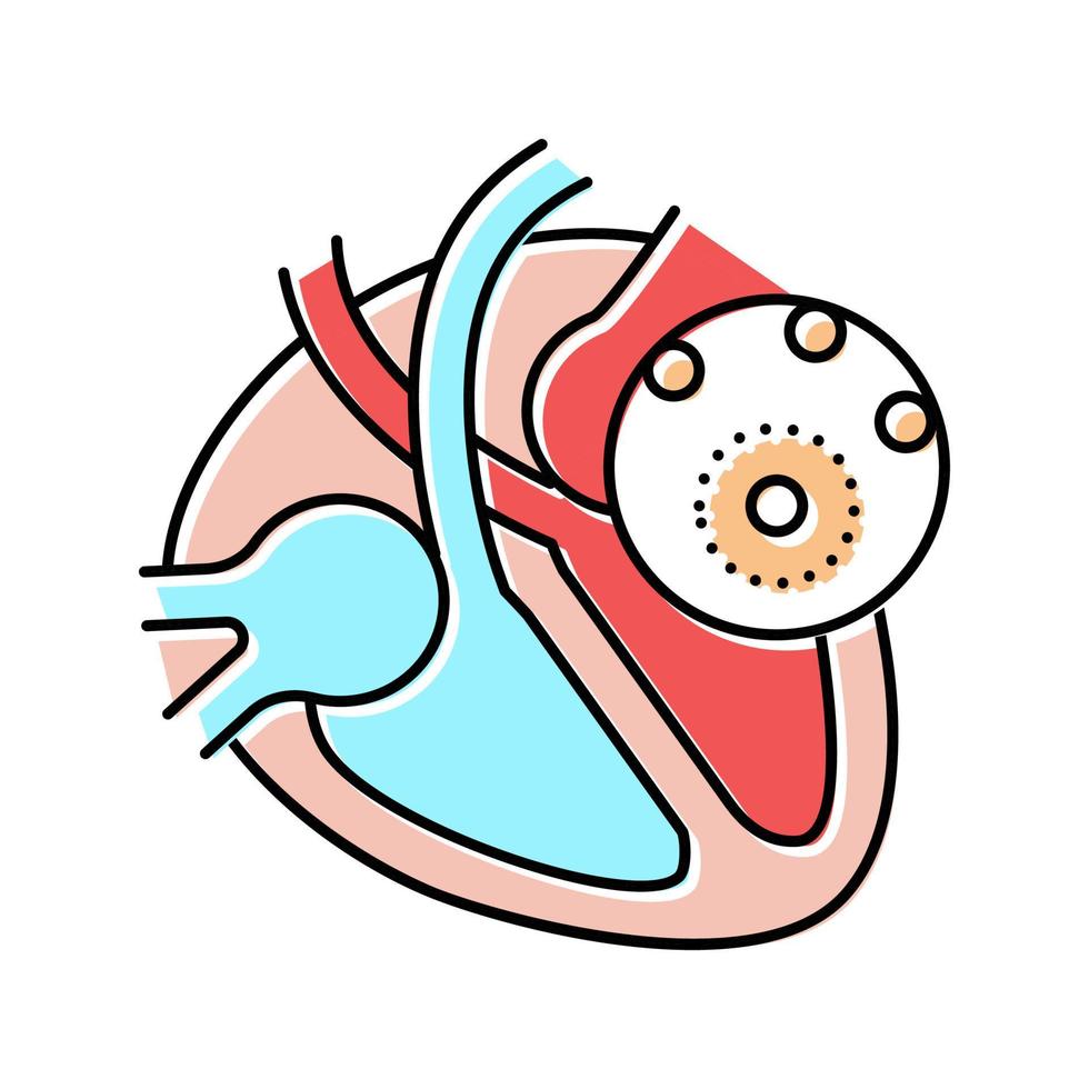 myocarditis ziekte kleur pictogram vectorillustratie vector