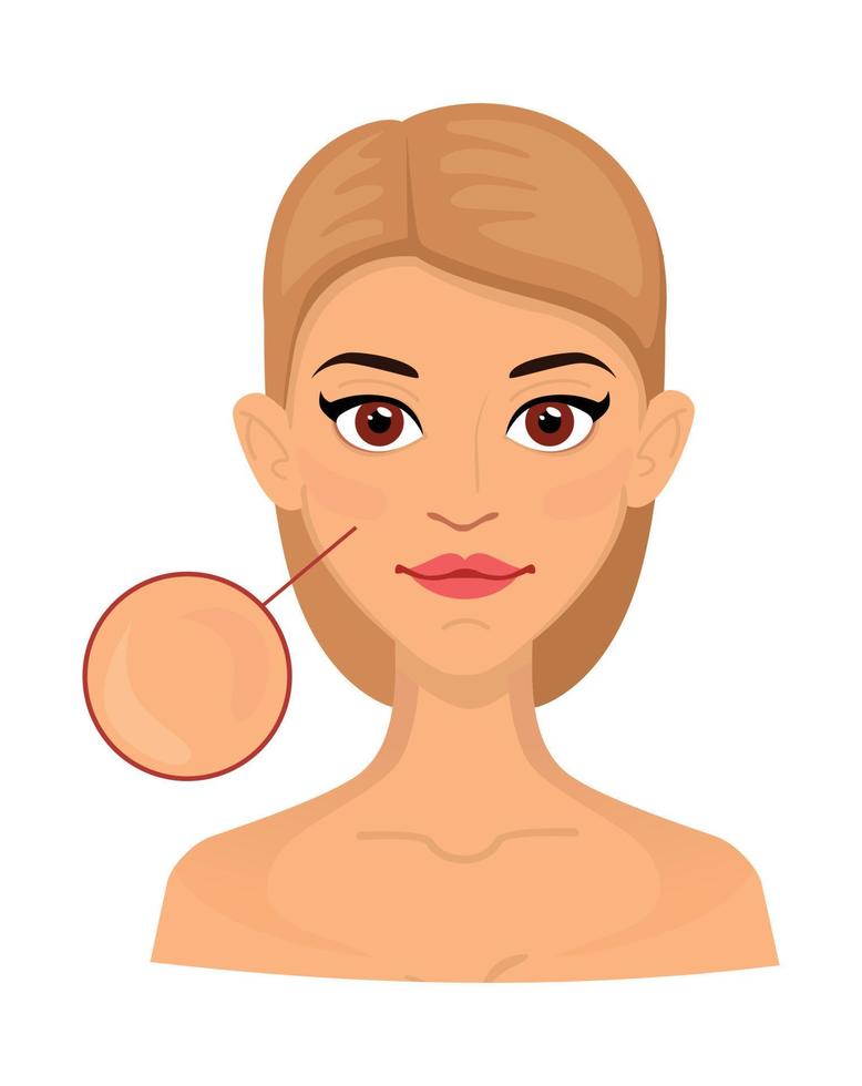 vrouw verschillend types van normaal huid, vergroot Oppervlakte voor cosmetologie. acne, rimpels en leeftijd vlekken. vector