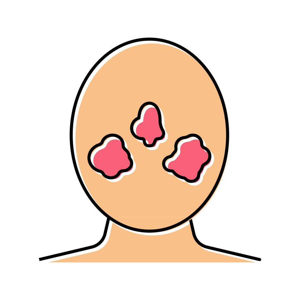 rosacea huidziekte kleur pictogram vectorillustratie vector