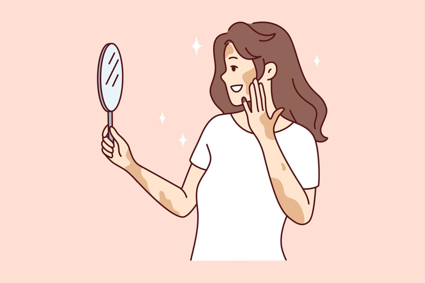 glimlachen vrouw met vitiligo kijken in spiegel gevoel lichaam positief. gelukkig meisje met huid ziekte voelen tevreden en optimistisch. huidsverzorging en dermatologie. vector illustratie.