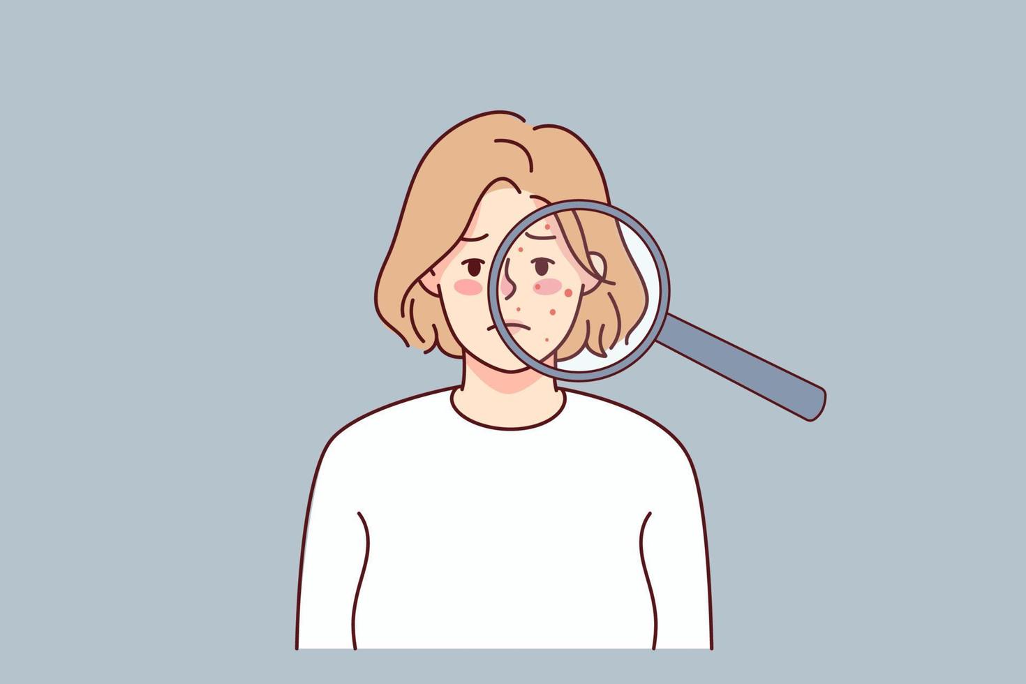 ongelukkig vrouw met acne Aan gezicht onder vergroten glas. van streek jong vrouw lijden van huidsverzorging problemen. dermatologie en cosmetologie. vector illustratie.